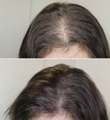 名古屋｜眉メイク・肌管理専門・白髪育毛ヘッドスパ【mire（ミレ）】完全プライベートサロン