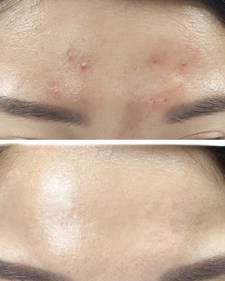 名古屋｜眉メイク・肌管理専門・白髪育毛ヘッドスパ【mire（ミレ）】完全プライベートサロン