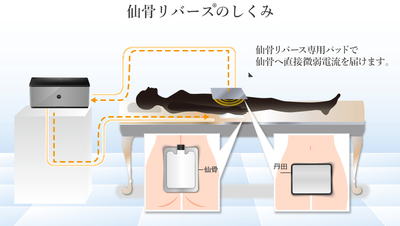 定額制（月額契約）