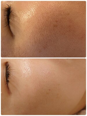 初回体験メニューございます。下にスクロースしてご希望のメニューをお選びください。