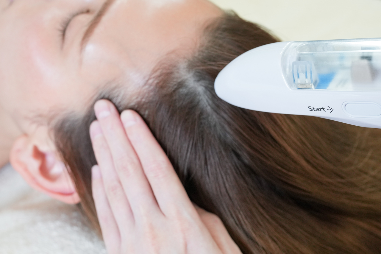 ミコステラ 頭皮ケア