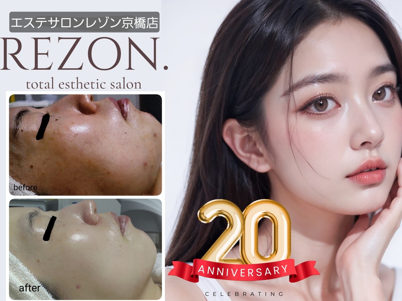 ご新規様ご予約☆ニキビケア・エンビロンエステ・ブライダルエステ：レゾン京橋店