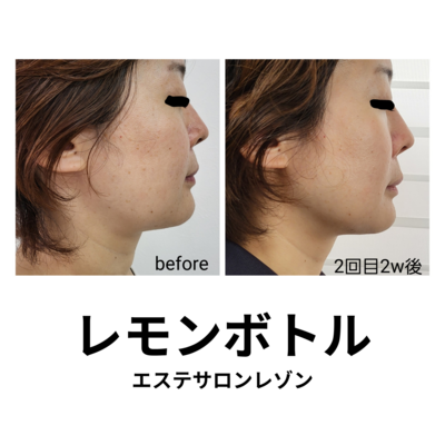 ご新規様ご予約はこちら