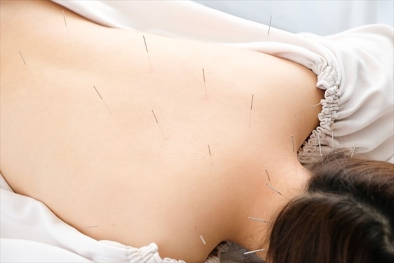 鍼灸予約ページ