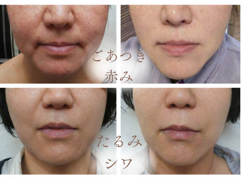 薬店内にあるフェイシャルエステ