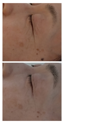 薬店内にあるフェイシャルエステ