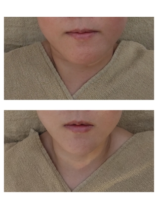 薬店内にあるフェイシャルエステ