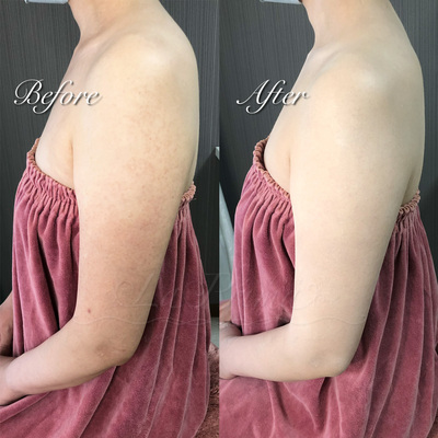 [奈良]ブライダルボディメイクお試し