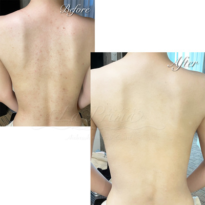 [奈良]ブライダルボディメイクお試し