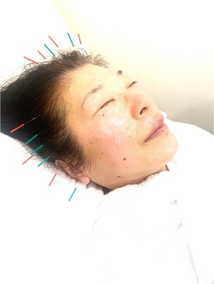 【施術の予約】