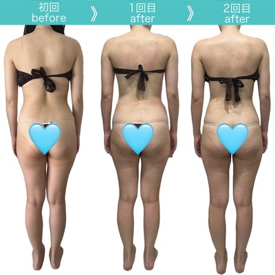 【大阪福島・野田】大人女性の睡眠×巡りケア｜深層リンパ ボディケアエステ｜private salon Lino