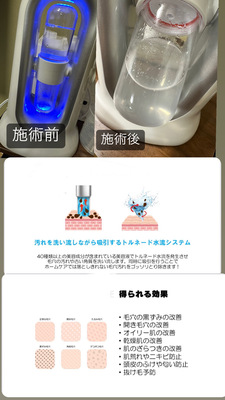 フェイシャルエステ
