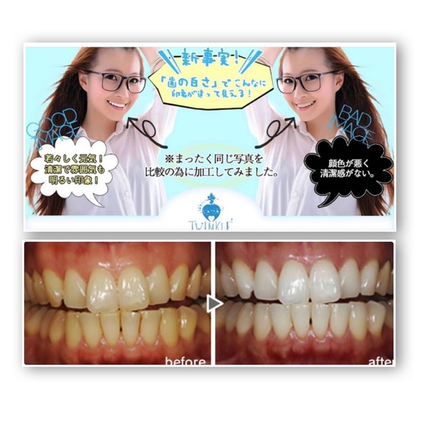 お客様の求める白さに合わせて、2種類のホワイトニングプランからお