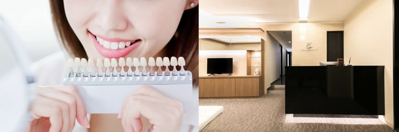 新宿ホワイトニング予約サイト　ご予約は無料です