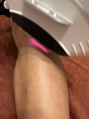 【初回】ヒゲ脱毛