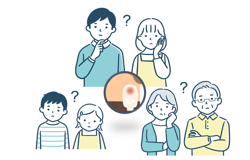 ストーマ保有者・ご家族様　受付予約