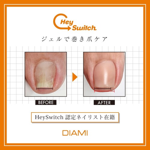 ヘイスイッチ Heyswitch 新品未使用 巻き爪ケア ベース＆トップ 正規品
