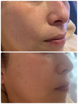 リジュベネ【施術メニュー】