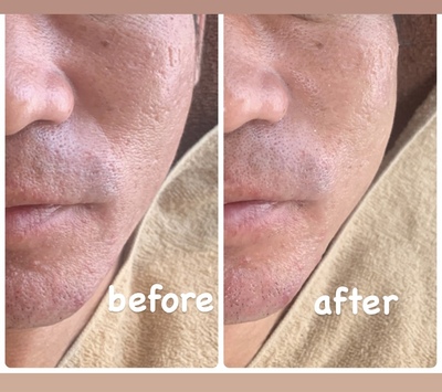 リジュベネ【施術メニュー】