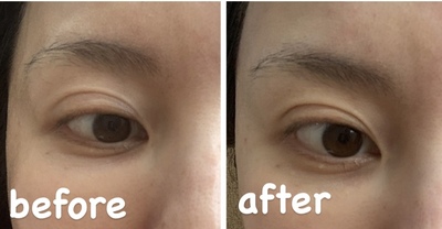 リジュベネ【施術メニュー】