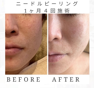 リジュベネ【施術メニュー】